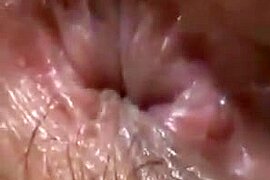 Anal fingering - free porn video